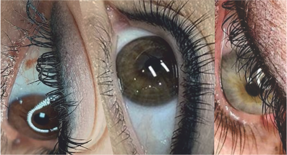 Micropigmentação de Olhos